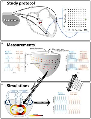 The Left and Right Ventricles Respond Differently to Variation of Pacing Delays in Cardiac Resynchronization Therapy: A Combined Experimental- Computational Approach